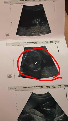 ปรึกษาหน่อยค่ะหรือใครพอจะมีประสบการณ์คล้ายๆกันบ้างมั้ยคะ😂