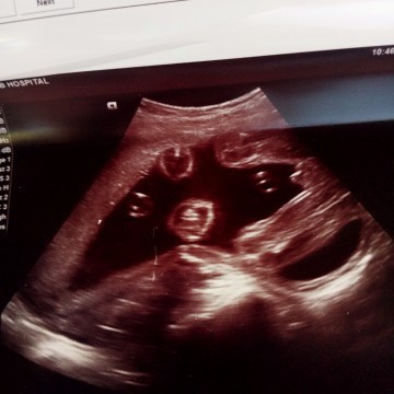 ผู้หญิงหรือผู้ชายค่ะ แม่ๆช่วยดูหน่อย🥺