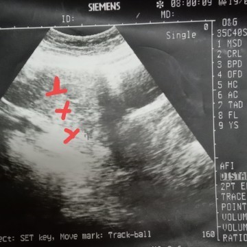 cuba lihat Twin ke tak