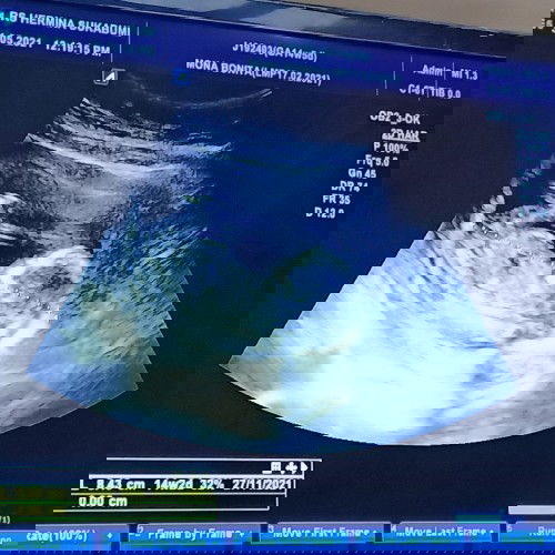 14w2d kebahagian ku 💗