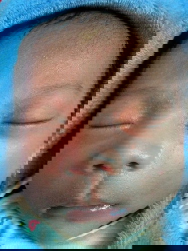 Wajah berbintik merah gatal