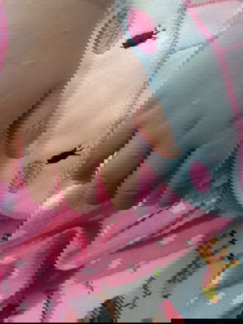 bintik kecil di sela" tangan bayi