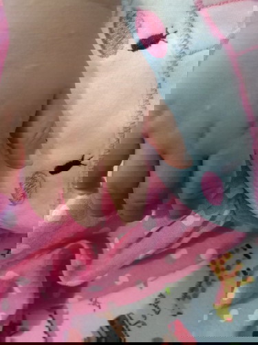 bintik kecil di sela" tangan bayi