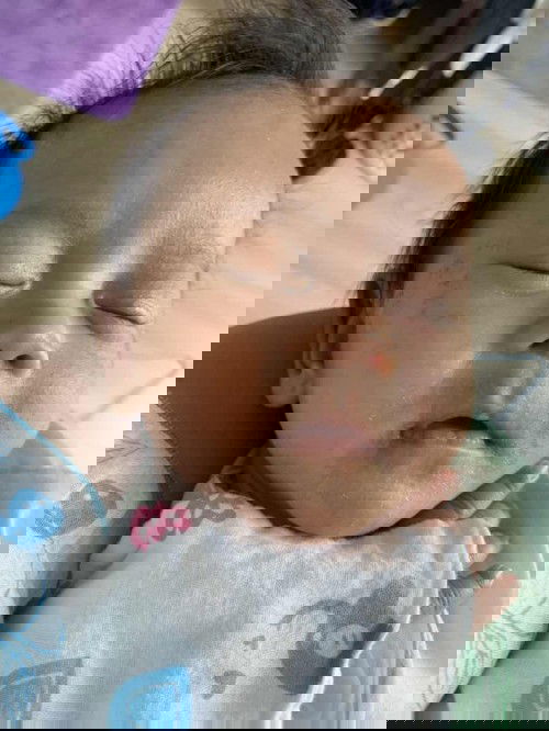 Ep1 เรื่องผื่นแดงของลูกน้อย