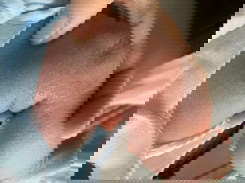 Ep3 #เรื่องผื่นแดงของลูกน้อย