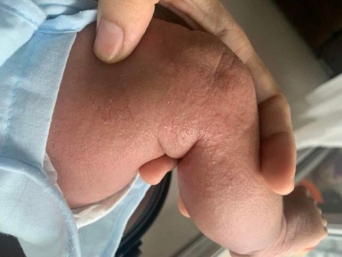 Ep3 #เรื่องผื่นแดงของลูกน้อย