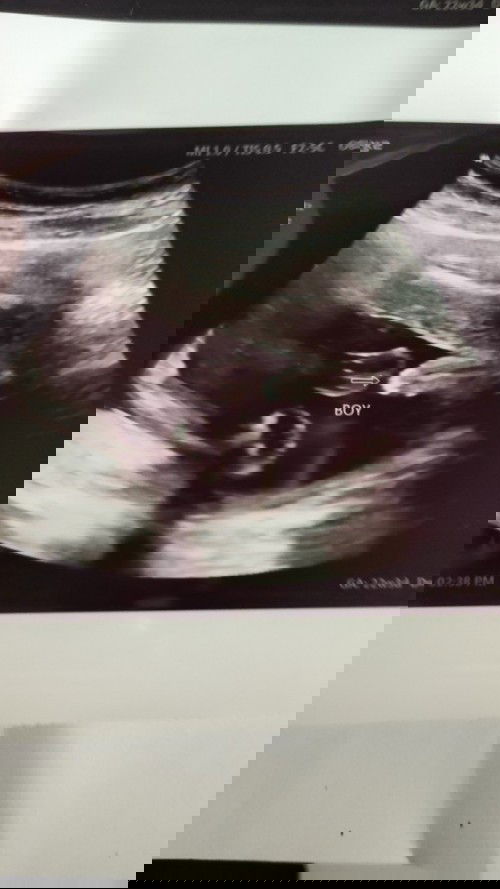 Assalamualaikum. Nak tanya ibu²,
Kalau scan baby, nmpk boboy macam ni. Confirm ke keluar pon boy?