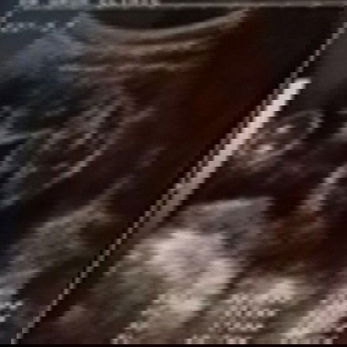 รบกวนแม่ๆช่วยดูให้หน่อยค่ะ