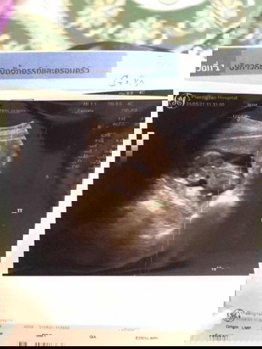 แม่ท้อเเล้วค่ะไม่นอนท่าดีๆสักครั้งเลยยอยากเห็นหน้าเเล้ว😒