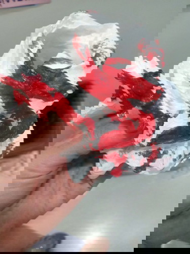 39+2 w โดนคุณหมอกระตุ้นเปิดปากมดลูก 1 เซนคะ