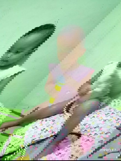 apakah anakku tidak cocok sama susu formula