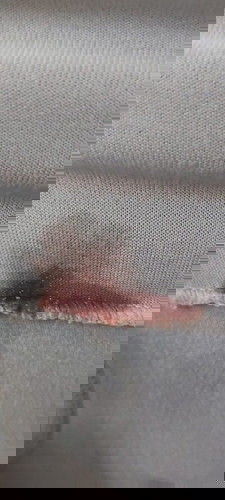 ท้องได้ 7 สัปดาห์เลือดออก