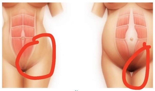 เจ็บตรงนี่มากเลยค่ะ แนะนำหน่อยค่ะ