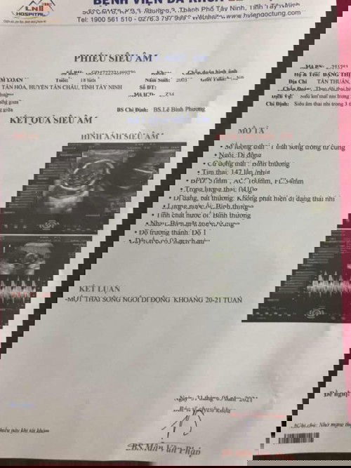 Bé dc 21 tuần cân nặng dc 410gr v có ổn chưa ạ