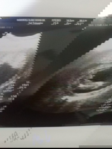 พ่อมาอวดเอง