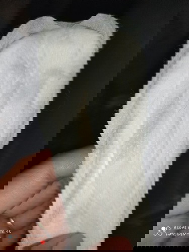 Normal lang po ba ito?