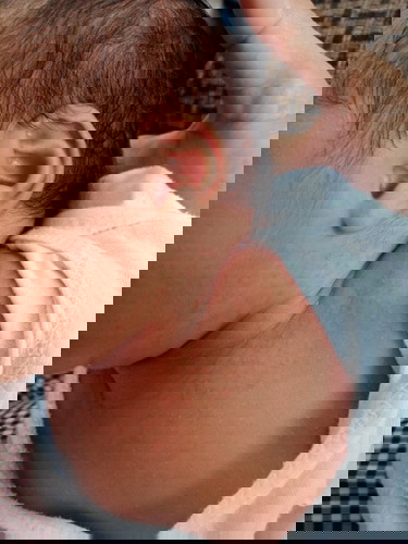 Mga momshie alam niyo po ba kung ano ito? O kaya naman anong maaring lunas para dito?