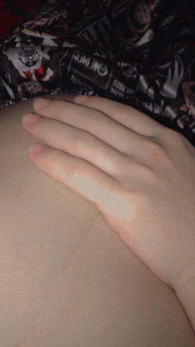 ลูกๆคุณแม่เป็นมั้ยคะ?