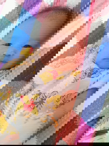 เด็กผ่าคลอด