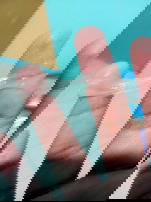 อันนี้เค้าเรียกว่ามูกขาวไหมค่ะ .?