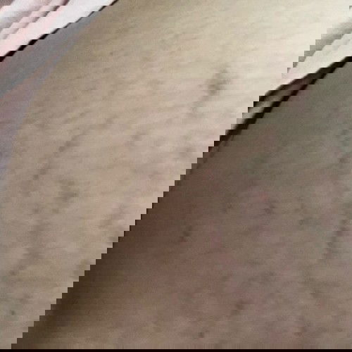 Có Mom nào tháng thứ 5 đã rạn như thế nào không ạ?
Em có Bôi Biol từ tháng thứ 2 nhưng vẫn rạn ạ😞