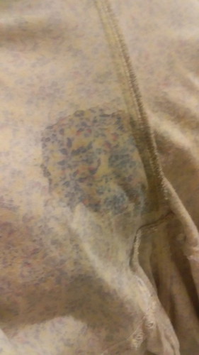 Ketuban rembes uk 37w5d