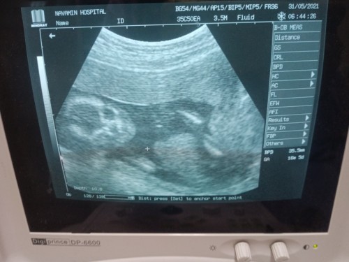 คุณแม่ว่าหนูผู้หญิงหรืผู้ชาย