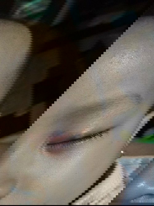 Ini bintitan bukan ya?