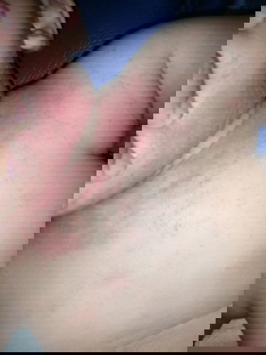 ช่วยแนะนำอาการที่คอของน้องหน่อยค่ะ