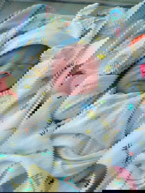 น้องไม่ลืมตา มีอาการตาบวม