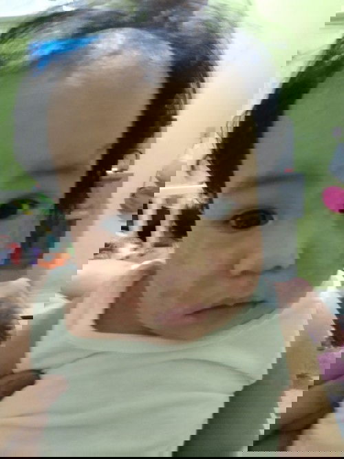 Makahiya rash or allergy rash?