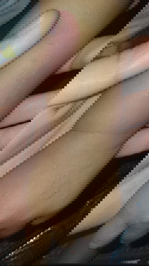 Bruntusan tidak berwarna