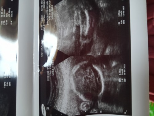 ชายรึหญิงค่ะ