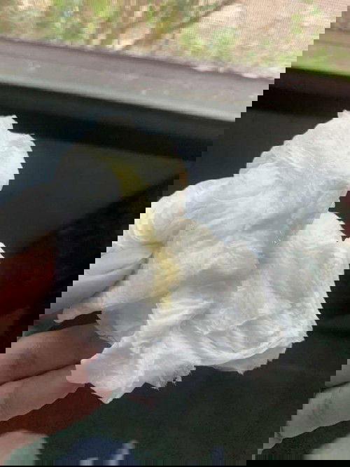 มีมูกใสๆออกมาแบบนี้หมายความว่าใกล้คลอดยังคะ