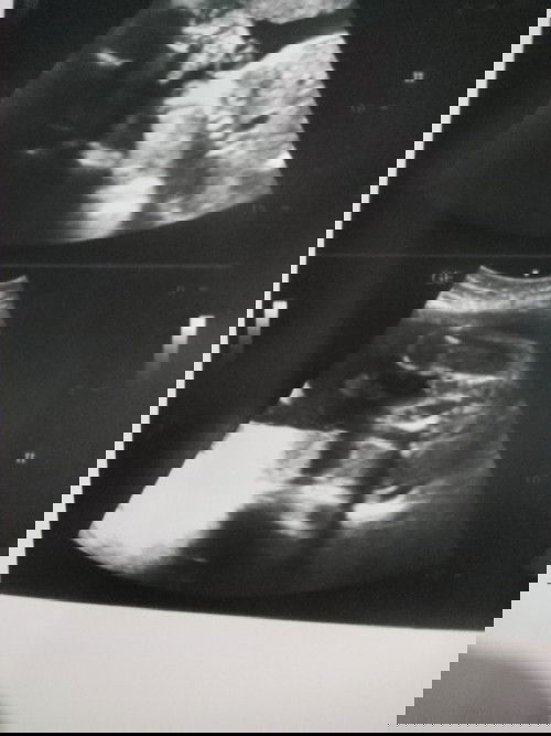 ภาพนี้เพศชายใช่ไหมคะ