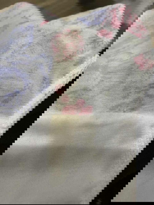 Yellow discharge during pregnancy