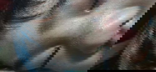 Rashes LANG po ba ito???