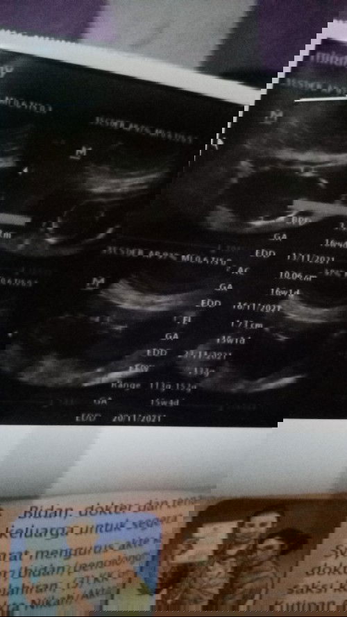 Usg beda 4week dari hpht