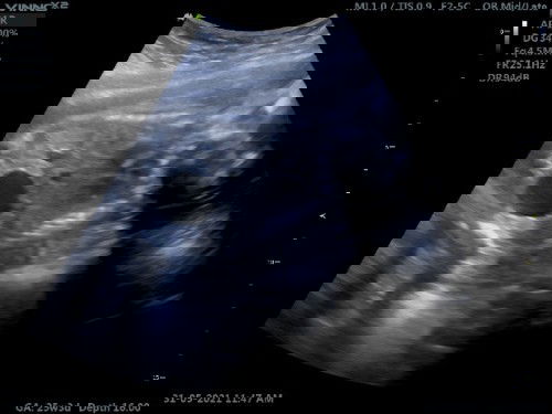 Minta pendapat semua