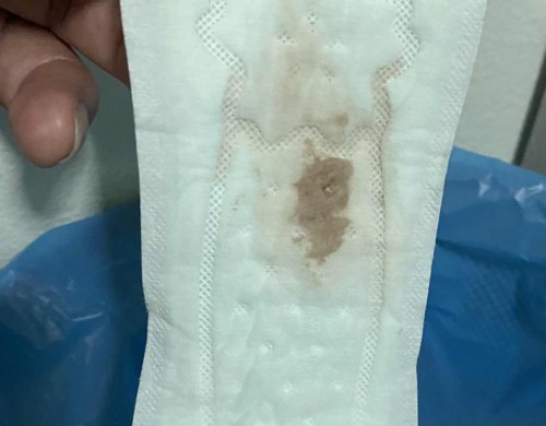 สอบถามแม่ๆหน่อยค่ะ แบบนี้ปกติไหมคะ