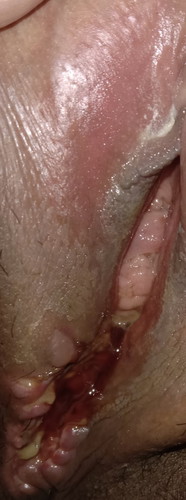 Bumuka po ba yung tahi ko sa pwerta??