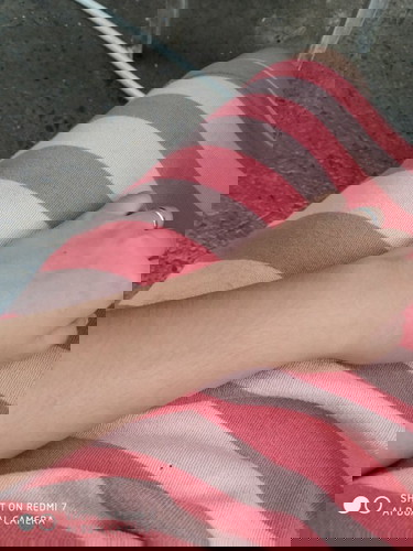 ASK KO LANG PO NORMAL LANG PO BA SA BUNTIS MANGITIM? Medyo nangitim po kasi skin ko 😭