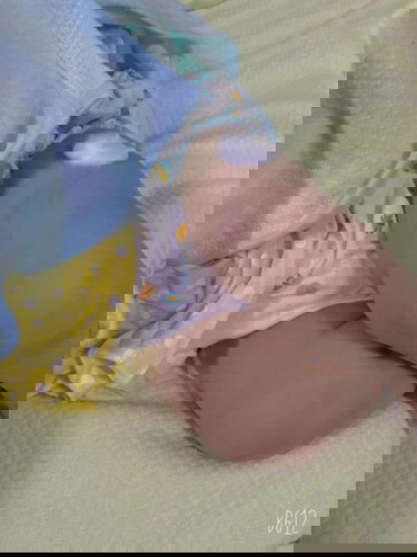 ไปฉีดยาทีหน้าขาสองข้างตอนนี้ไข้สูงมาก จากทีเคยพลิกตัวคว่ำให้ตอนนี้พลิกไม่ใด้เลย ต้องทำยังไงคะ