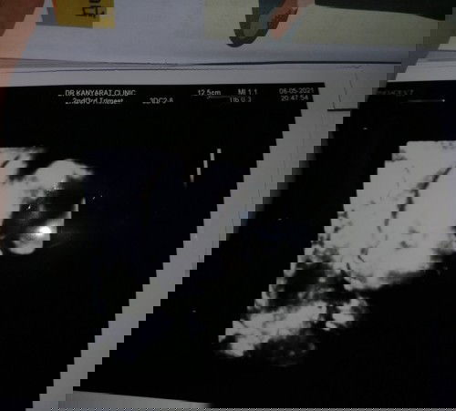 30+4​ น้ำหนักไม่ขึ้นเลย