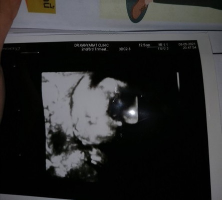 30+4 น้ำหนักไม่ขึ้นเลย