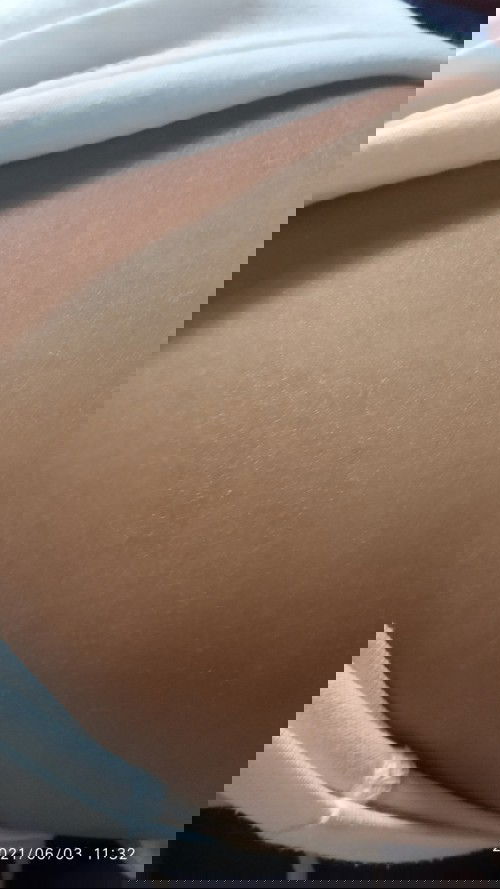 Dry skin on the back