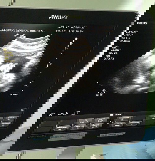 ลูกตัวเล็กค่ะ อยากได้รายการอาหารที่ช่วยเพิ่มน้ำหนักลูก