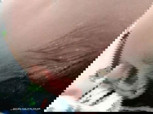 Bruntusan dikepala bayi