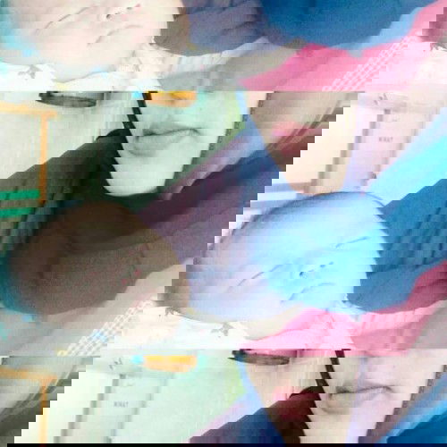 Alhamdulillah bayi prematur ku skrg udah normal....