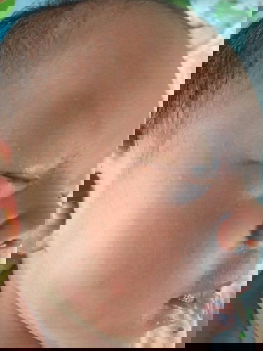 ขอคำแนะนำหน่อยค่ะ 
ลูกเป็นตุ่มเล็กๆแดงๆเต็มหน้า ใช้ยาอะไรทาดี ถึงจะหาย